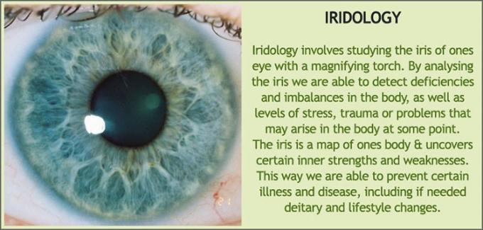 iridology iris নির্ণয়ের