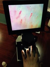 পেরেক পরীক্ষার জন্য সিই অনুমোদিত অনুমোদিত ই এম LCD স্ক্রিন রঙ Microcirculation মাইক্রোস্কোপ
