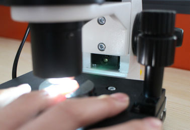 সাব হেলথ চেকিংয়ের জন্য সঠিক রঙের LCD Nailfold Capillary Microcirculation মাইক্রোস্কোপ ডিভাইস