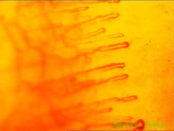 শারীরিক স্বাস্থ্য সনাক্ত করার জন্য রক্তের কৈশিক মাইক্রোস্কোপ, 1 বছরের ওয়ারেন্টি